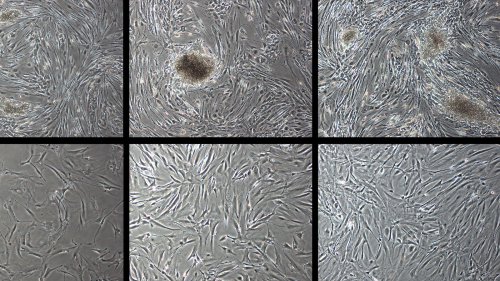 Turning back the clock: Human skin cells de-aged by 30 years in trial