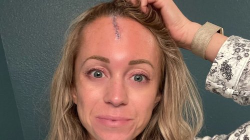 Major League Baseball reporter Kelsey Wingert in hospital after being hit in head by 95mph ball