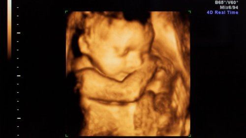30. SSW: Babys Gewicht, Größe und Entwicklung – das tut sich jetzt im Bauch