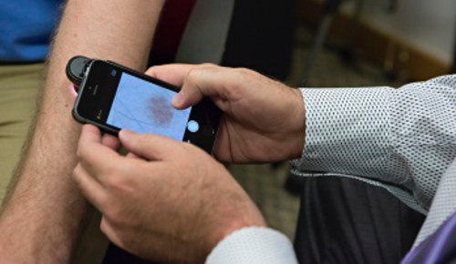iPhone app screens for skin cancer more accurately than your doctor, shows early testing