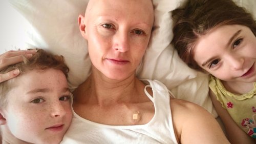 The sneaky breast cancer I almost missed — and how other women can look out for it