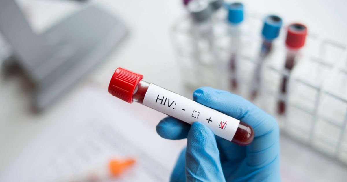 13 Signs You May Have HIV