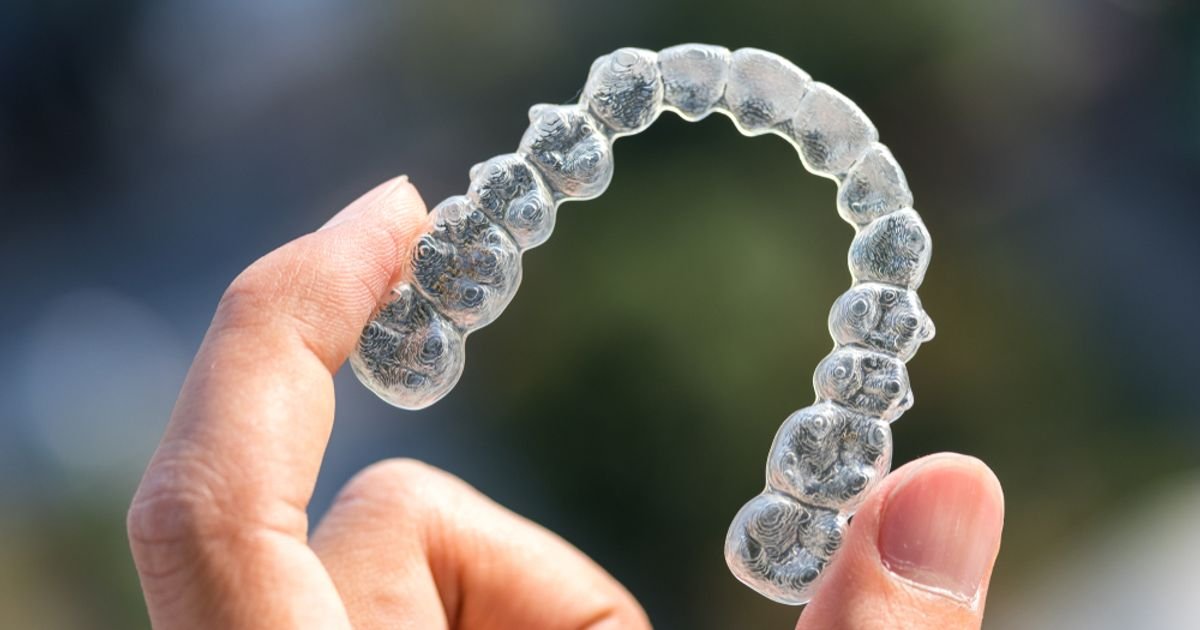 What to Expect with Invisalign Braces - ActiveBeat