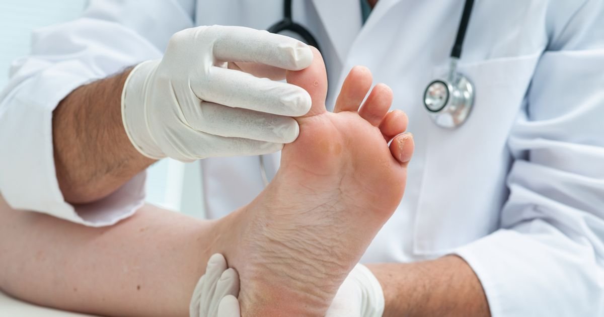 Important Facts to Know About Gout - cover