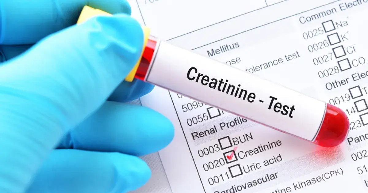 How to Lower Creatinine Levels Fast
