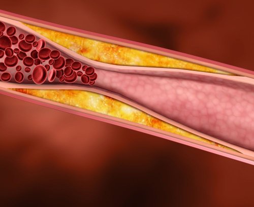 The Truth About Cholesterol