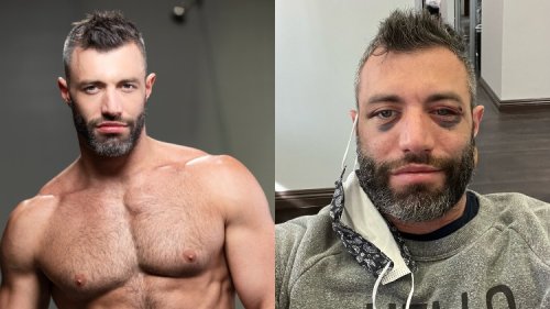 Gay Adult Performer Cole Connor Beaten, Mugged By a Group of Men