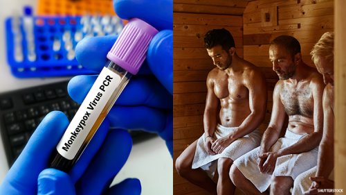 Monkeypox Outbreak Linked to Gay Sauna and Festival