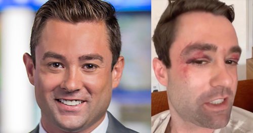 Former Fox 5 Meteorologist Adam Klotz Attacked In Nyc Subway Flipboard 3336