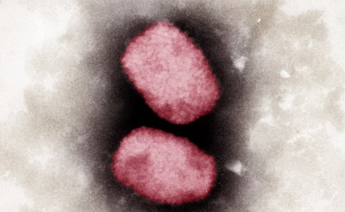 Denmark, Scotland detect first monkeypox virus cases