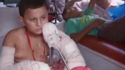 Germany treats Gaza's wounded children