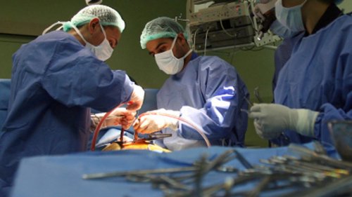 Neurosurgeon to attempt world’s first head transplant