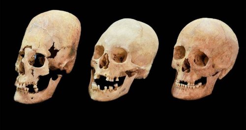 Dozens Of Elongated Skulls Found In An Ancient Cemetery In Hungary Provides Clues About The Fall Of Rome