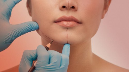 These Will Be the Biggest Plastic Surgery Trends for 2023