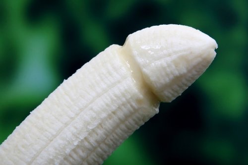 Phimosis : causes, complications et traitement