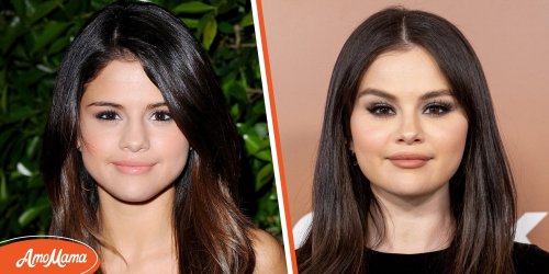 Selena Gomez & Plastic Surgery: Experts Claim She Had Work Done | Flipboard