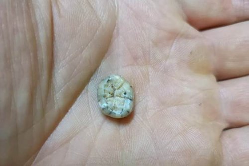 Denisovan Girl’s Tooth Is First Physical Evidence of Denisovans in Southeast Asia!