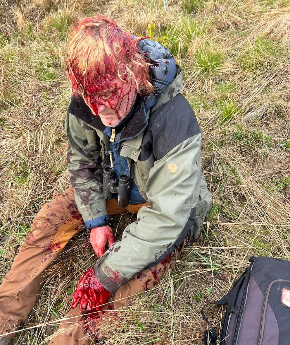 Wildlife Filmmaker Faces Harrowing Bear Attack | Flipboard