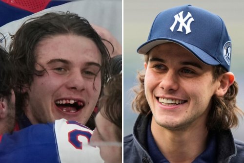 Olympic hero Jack Hughes' new chicklets give NHL dentists moment in spotlight