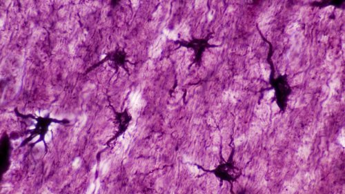 Astrocytes play a key role in memory