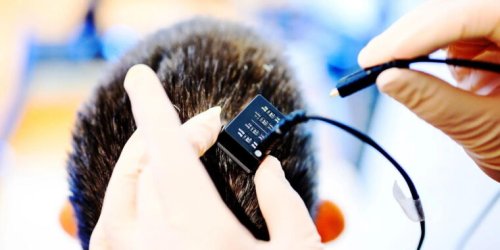 AI-powered brain implants help paralyzed patients communicate faster than ever