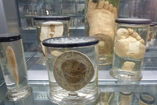 Where to see the world's most famous preserved body parts
