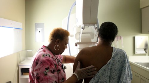 Study finds gaps in reporting harms from U.S. cancer screenings