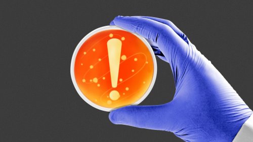 New bacterial clues about why young people are getting colorectal cancer