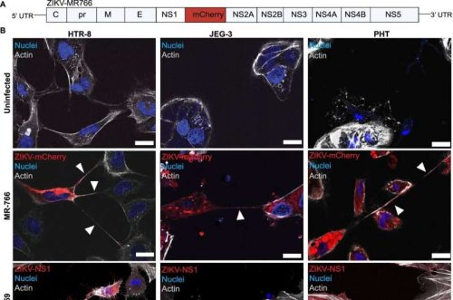 Zika Virus Uses Nanotubes for Placental Spread
