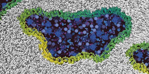 Protein serves as a breaking point for cell membrane rupture during cell death