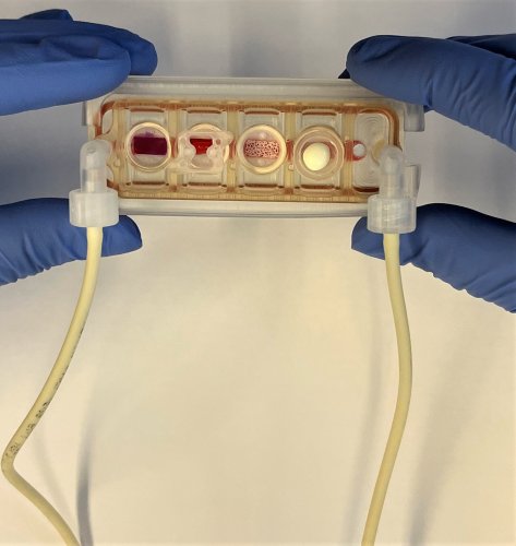 Plug-and-play organ-on-a-chip can be customized to the patient