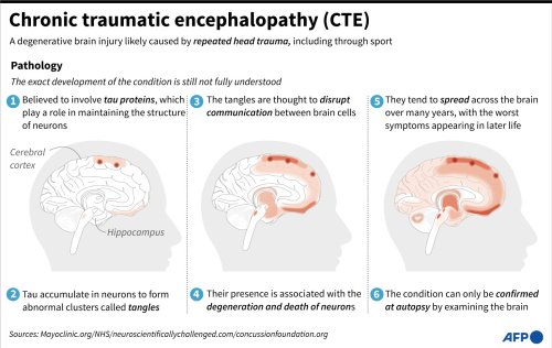 chronic-traumatic-encephalopathy-cte-flipboard