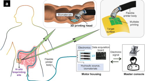 3D-Drucker: Roboterarm soll Gewebe innerhalb unseres Körpers drucken