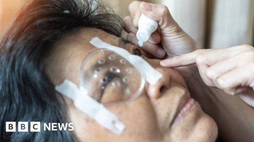 Macular degeneration: Link found in eye disease treatment