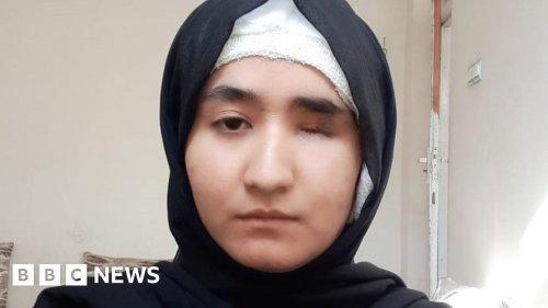 Afghan female student injured in suicide attack passes university entrance exams