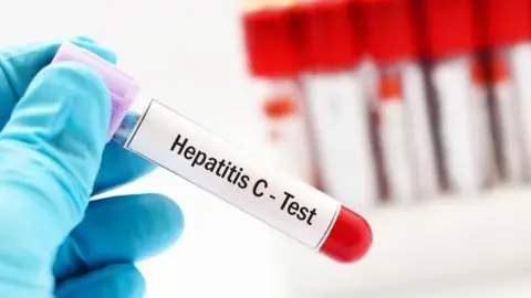 GP patients to help NHS find more infected blood victims