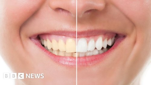 'Dangerous' home teeth-whitening kits sold online