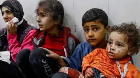 Israel-Gaza war: Half of Gaza's population is starving, warns UN