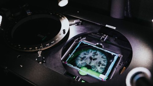 Human intelligence: it’s how your brain is wired rather than size that matters
