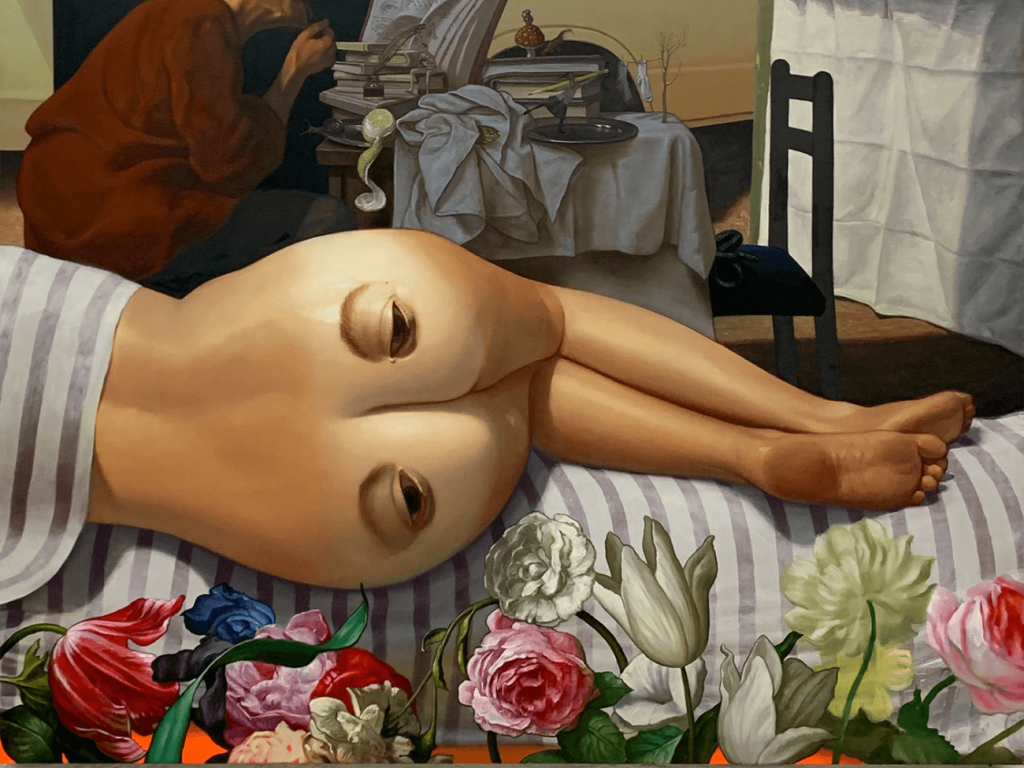 ART
