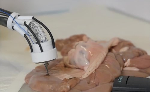 Cette imprimante 3D permet de réparer les tissus endommagés de l'intérieur