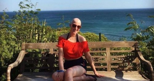 Co Antrim student shares experience with Alopecia to break hair loss stigma