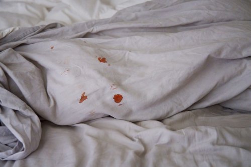 Is Bleeding After Sex Normal? 16 Things to Know