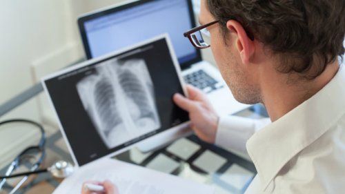 Tuberculose: l'OMS alerte sur une hausse des morts dues à la maladie en Europe