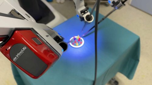 Nice: un nouveau robot pour traiter certains cancers au centre Antoine Lacassagne