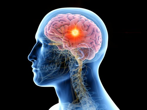 Breakthrough tech can detect Alzheimer's in a single brain scan