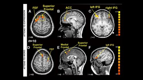 Uh-Oh. Is Our Faith in fMRI Brain Studies Misplaced?