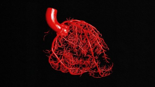Experimental drug cuts heart disease risk factor by 96%