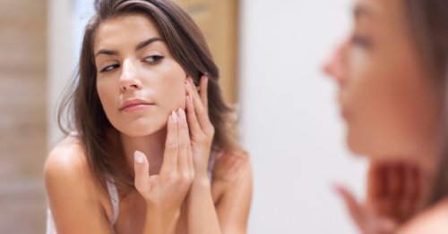 Acne is a "disease of Western civilization." Is overwashing to blame?