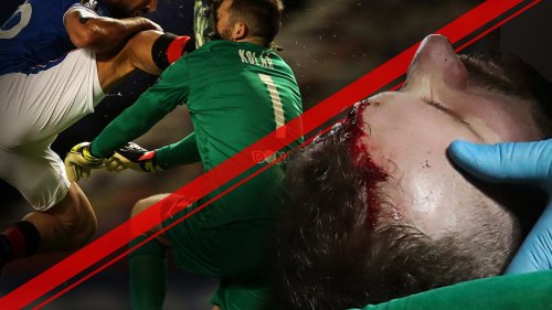 Übler Kopf-Tritt in der Europa League